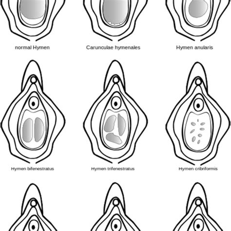 defloration in tagalog|The little tissue that couldn’t – dispelling myths about the Hymen’s .